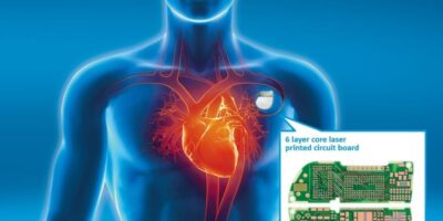 Medical implants get onboard with PCB growth