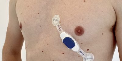 Smart health patch adapts to measure Covid-19 patients