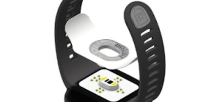 Smart watch continuously monitors glucose levels