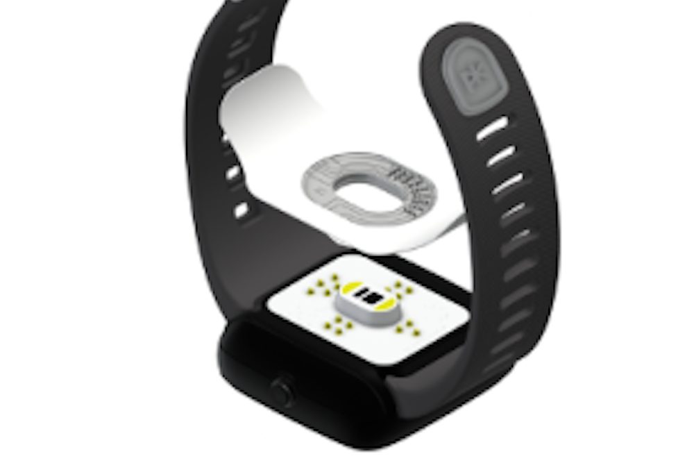 Smart watch continuously monitors glucose levels